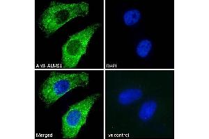 (ABIN184952) Immunofluorescence analysis of paraformaldehyde fixed HeLa cells, permeabilized with 0. (ALMS1 抗体  (C-Term))