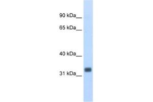 Western Blotting (WB) image for anti-Ets Homologous Factor (EHF) antibody (ABIN2462031) (EHF 抗体)