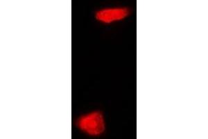 Immunofluorescent analysis of PHYHD1 staining in MCF7 cells. (PHYHD1 抗体)
