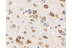Immunohistochemistry analysis of paraffin-embedded mouse brain using DCX Polyclonal Antibody at dilution of 1:400. (Doublecortin 抗体)