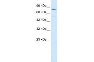 Human HepG2; WB Suggested Anti-ZNF341 Antibody Titration: 0. (ZNF341 抗体  (Middle Region))