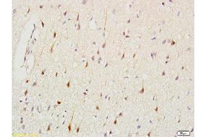 Immunohistochemistry (Paraffin-embedded Sections) (IHC (p)) image for anti-Keratin 2 (KRT2) (AA 535-638) antibody (ABIN730813)