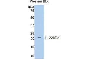 Detection of Recombinant IL18BP, Rat using Polyclonal Antibody to Interleukin 18 Binding Protein (IL18BP) (IL18BP 抗体  (AA 29-193))