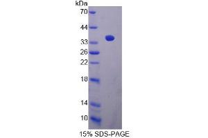 SDS-PAGE analysis of Mouse CABIN1 Protein. (CABIN1 蛋白)
