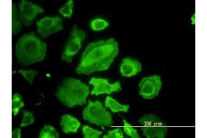 Immunofluorescence (IF) image for anti-Cell Division Cycle 37 Homolog (S. Cerevisiae) (CDC37) (AA 1-378) antibody (ABIN564833)