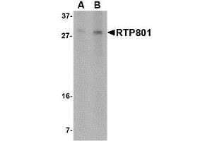 Image no. 1 for anti-DNA-Damage-Inducible Transcript 4 (DDIT4) (N-Term) antibody (ABIN1494371)