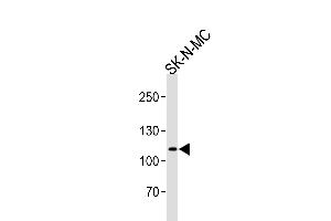 Western blot analysis of lysate from SK-N-MC cell line, using NOC3L Antibody (N-term) (ABIN657897 and ABIN2846849). (NOC3L 抗体  (N-Term))