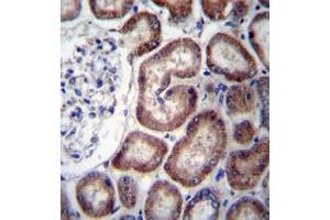 Immunohistochemistry analysis in formalin fixed and paraffin embedded human kidney tissue reacted with IREB2 Antibody (Center) followed by peroxidase conjugation of the secondary antibody and DAB staining.