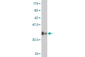 Western Blot detection against Immunogen (35. (CCRN4L 抗体  (AA 64-152))