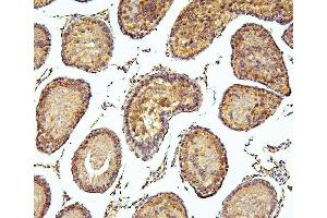 IHC analysis of PEF1 using anti-PEF1 antibody (ABIN6719632). (PEF1 抗体  (AA 170-284))