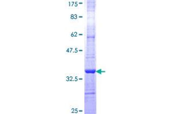 GALC Protein (AA 596-669) (GST tag)