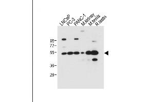 All lanes : Anti-DMRT3 Antibody (C-term) at 1:500 dilution Lane 1: LNCaP whole cell lysate Lane 2: PC-3 whole cell lysate Lane 3: NC-1 whole cell lysate Lane 4: Mouse kidney tissue lysate Lane 5: Mouse testis tissue lysate Lane 6: Rat testis tissue lysate Lysates/proteins at 20 μg per lane. (DMRT3 抗体  (C-Term))