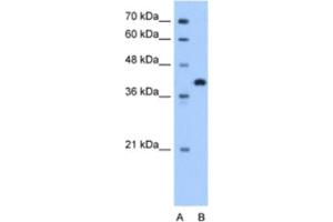 Western Blotting (WB) image for anti-Torsin Family 2, Member A (TOR2A) antibody (ABIN2463328) (TOR2A 抗体)