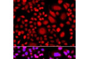 Immunofluorescence analysis of A549 cells using PRKAG3 Polyclonal Antibody (PRKAG3 抗体)