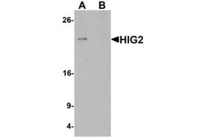 Western blot analysis of HIG2 in 3T3 cell lysate with HIG2 antibody at 1 ug/mL in (A) the absence and (B) the presence of blocking peptide. (HILPDA 抗体  (C-Term))