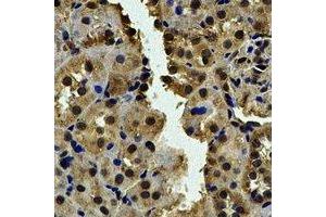 Immunohistochemical analysis of CALCOCO1 staining in human kidney formalin fixed paraffin embedded tissue section. (CALCOCO1 抗体)