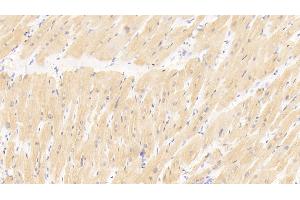 Detection of MYL3 in Human Cardiac Muscle Tissue using Polyclonal Antibody to Myosin Light Chain 3, Alkali, Ventricular, Slow Skeletal (MYL3) (MYL3/CMLC1 抗体  (AA 5-181))