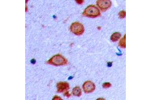 Immunohistochemical analysis of PRKD2 (pS876) staining in human brain formalin fixed paraffin embedded tissue section. (PKD2 抗体  (C-Term, pSer876))