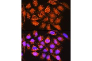 Immunofluorescence analysis of HeLa cells using B1 Rabbit pAb (ABIN1678629, ABIN3018003, ABIN3018005 and ABIN6220332) at dilution of 1:100. (ALDH1B1 抗体  (AA 278-517))