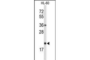 Western blot analysis of RNH2C Antibody (Center) (ABIN653251 and ABIN2842775) in HL-60 cell line lysates (35 μg/lane). (RNASEH2C 抗体  (AA 80-108))