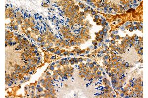 ABIN6261582 and ABIN6276939 at 1/100 staining Mouse testis tissue by IHC-P. (EPXH2 (C-Term) 抗体)