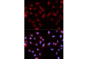 Immunofluorescence analysis of U2OS cells using BIRC5 antibody (ABIN5970737). (Survivin 抗体)