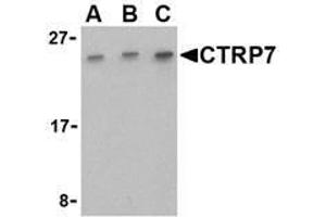 Western blot analysis of CTRP7 in 293 cell lysate with AP30258PU-N CTRP7 antibody at (A) 0. (CTRP7 抗体  (C-Term))