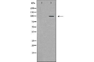 Western blot analysis of HeLa  lysate using PML antibody. (PML 抗体  (N-Term))