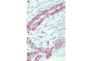 Immunohistochemical staining of human kidney (A) and human breast (B) with SLC4A2 polyclonal antibody . (SLC4A2 抗体  (N-Term))