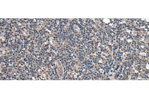 Immunohistochemistry of paraffin-embedded Human tonsil tissue using BRI3BP Polyclonal Antibody at dilution of 1:35(x200) (BRI3BP 抗体)