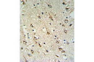 Immunohistochemistry (Paraffin-embedded Sections) (IHC (p)) image for anti-DnaJ (Hsp40) Homolog, Subfamily C, Member 6 (DNAJC6) (AA 254-281) antibody (ABIN653940)