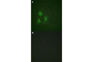 Immunofluorescence staining of methanol-fixed A-549 cells with PRKACA/PRKACB (phospho T197) polyclonal antibody  without blocking peptide (A) or preincubated with blocking peptide (B) at 1:100-1:200 dilution.