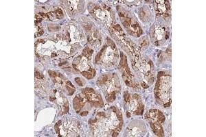 Immunohistochemical staining of human kidney with C10orf129 polyclonal antibody  shows moderate cytoplasmic positivity in renal tubules. (C10ORF129 抗体)