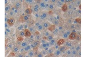 Immunohistochemistry (IHC) image for anti-Cyclin D2 (CCND2) (AA 47-267) antibody (ABIN7439681)