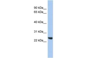Western Blotting (WB) image for anti-Proteasome (Prosome, Macropain) Subunit, beta Type 2 (PSMB2) antibody (ABIN2463959) (PSMB2 抗体)