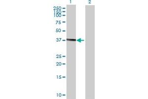 Western Blotting (WB) image for B4GALNT1 293T Cell Transient Overexpression Lysate(Denatured) (ABIN1331900)
