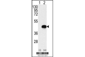 Western blot analysis of BCKDK using rabbit polyclonal BCKDK Antibody using 293 cell lysates (2 ug/lane) either nontransfected (Lane 1) or transiently transfected with the BCKDK gene (Lane 2). (BCKDK 抗体  (AA 120-151))