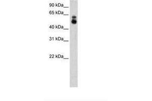 Image no. 2 for anti-Histone Deacetylase 9 (HDAC9) (C-Term) antibody (ABIN205000) (HDAC9 抗体  (C-Term))