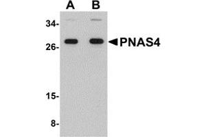 Western Blotting (WB) image for anti-PPPDE Peptidase Domain Containing 1 (PPPDE1) (C-Term) antibody (ABIN1030594) (PPPDE1 抗体  (C-Term))