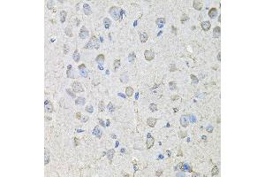 Immunohistochemistry of paraffin-embedded mouse brain using CD97 antibody at dilution of 1:100 (x40 lens). (CD97 抗体)