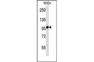 Western blot analysis of ITGB7 Antibody (C-term) in WiDr cell line lysates (35ug/lane). (Integrin beta 7 抗体  (C-Term))