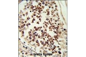 Immunohistochemistry (Paraffin-embedded Sections) (IHC (p)) image for anti-Second Mitochondria-Derived Activator of Caspase (DIABLO) (AA 211-239), (C-Term) antibody (ABIN6243156)
