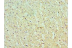 Immunohistochemistry (IHC) image for anti-serpin Peptidase Inhibitor, Clade A (Alpha-1 Antiproteinase, Antitrypsin), Member 1 (SERPINA1) (AA 165-444) antibody (ABIN7166367)