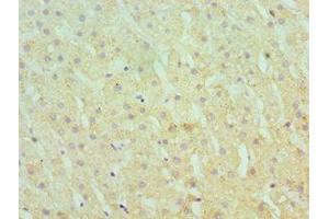 Immunohistochemistry of paraffin-embedded human liver tissue using ABIN7166367 at dilution of 1:100 (SERPINA1 抗体  (AA 165-444))