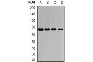Western blot analysis of Citrin expression in HepG2 (A), Hela (B), mouse liver (C), mouse kidney (D) whole cell lysates. (slc25a13 抗体)