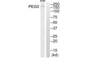 Western Blotting (WB) image for anti-Paternally Expressed 3 (PEG3) (Internal Region) antibody (ABIN1849956) (PEG3 抗体  (Internal Region))