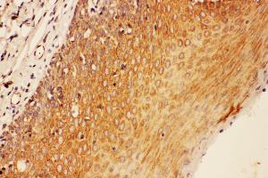 Anti-SOCS3 antibody, IHC(P) IHC(P): Human Tonsil Tissue (SOCS3 抗体  (Middle Region))
