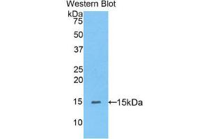 Western Blotting (WB) image for anti-Peroxisome Proliferator-Activated Receptor delta (PPARD) (AA 29-147) antibody (ABIN1175443) (PPARD 抗体  (AA 29-147))