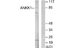 Western blot analysis of extracts from HeLa cells, using ANKK1 antibody. (ANKK1 抗体)