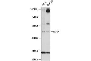Western blot analysis of extracts of various cell lines, using NCEH1 antibody (ABIN7268897) at 1:1000 dilution. (NCEH1 抗体  (AA 90-440))